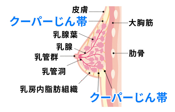 クーパーじん帯のダメージ
