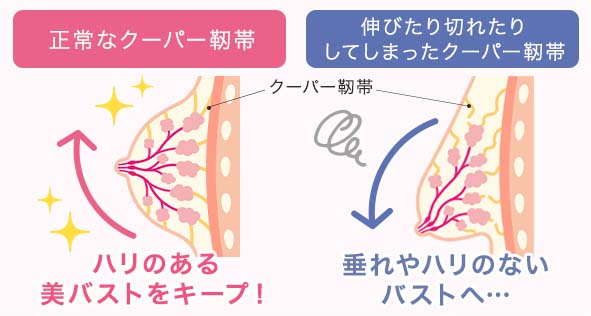 クーパー靭帯を強くしてハリのある美バストをキープ！